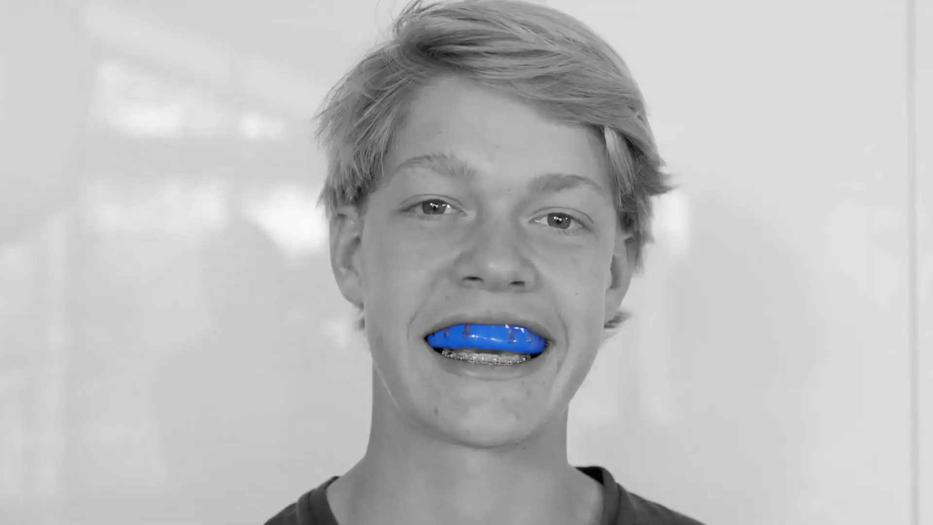 Young man wearing a blue Neomorph Mouthguard with braces