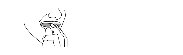 Gently flare the top border of the guard out and pull forward to peel it away from the orthodontic appliances.