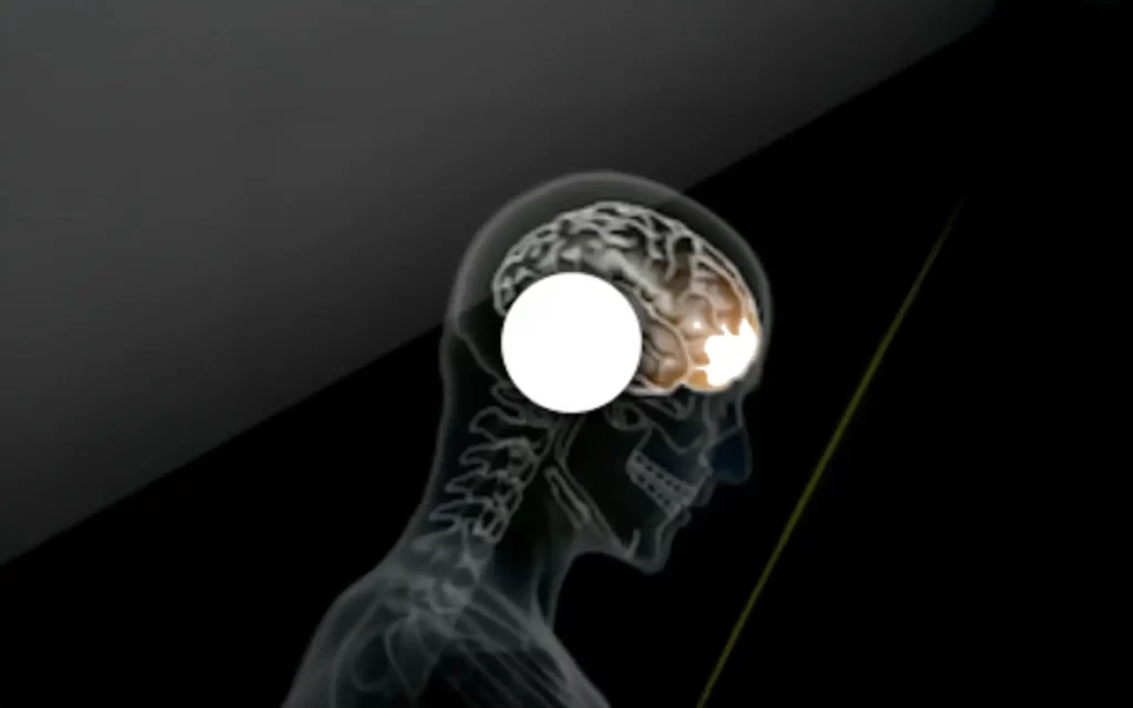 An illustration of a concussion impact